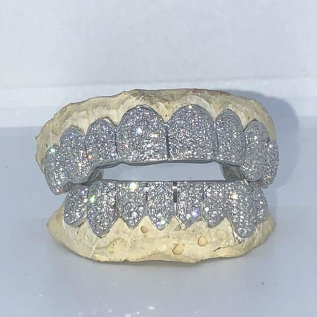 VVS Diamond Grillz Grill Free Shipping and Free Mold Kits - Etsy Australia