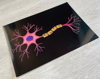 May include: A pink and purple neuron with a yellow myelin sheath on a black background.