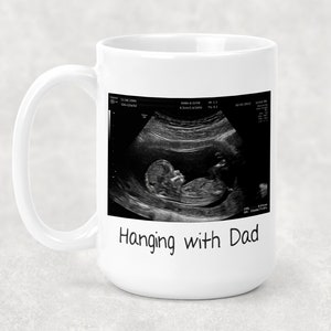 Echografie Mok, Aanstaande ouders cadeau, Baby douche aanwezig, Zwangerschap onthullen, Vaderdag, Papa om cadeau idee te zijn, geschenken voor hem, Papa mok