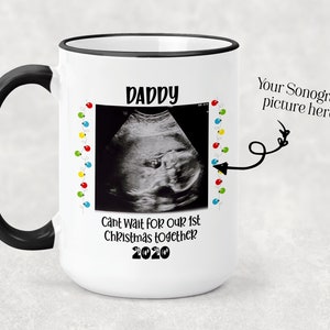 Christmas ULTRASOUND picture mug, Personalized Mugs, Coffee mug for Dads; Christmas Gift for dads; Dad to be gift; Pregnancy reveal gift