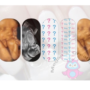 以下が含まれることがあります： 子宮内の赤ちゃんの画像が4つあり、2つは3D超音波画像、2つは2D超音波画像です。画像は、ピンクとブルーの疑問符のパターンが描かれた白い背景で囲まれています。「Boy? Girl」というテキストが、ブルーとピンクのテキストで複数回繰り返されています。画像の下中央には、青い目をしたピンクのフクロウがいます。