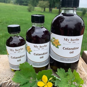 Puede incluir: Tres botellas de vidrio de aceite de celidonia, etiquetadas con "My herbs for you", con la botella más grande en el centro y la botella más pequeña a la izquierda. Las botellas están sobre una superficie de madera con hojas verdes y flores amarillas.