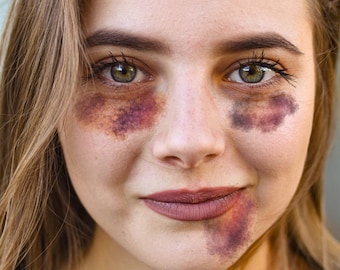 Black Eye Temporary Tattoo (Set of 3) - Bruise Hickey Temporary Tattoo Love Bite / Realistic Bruise Hicky Tattoo