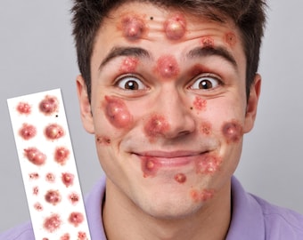 Nasty Large Boils Temporary Tattoo Set - Halloween Costume FX Boils Pimples Plague