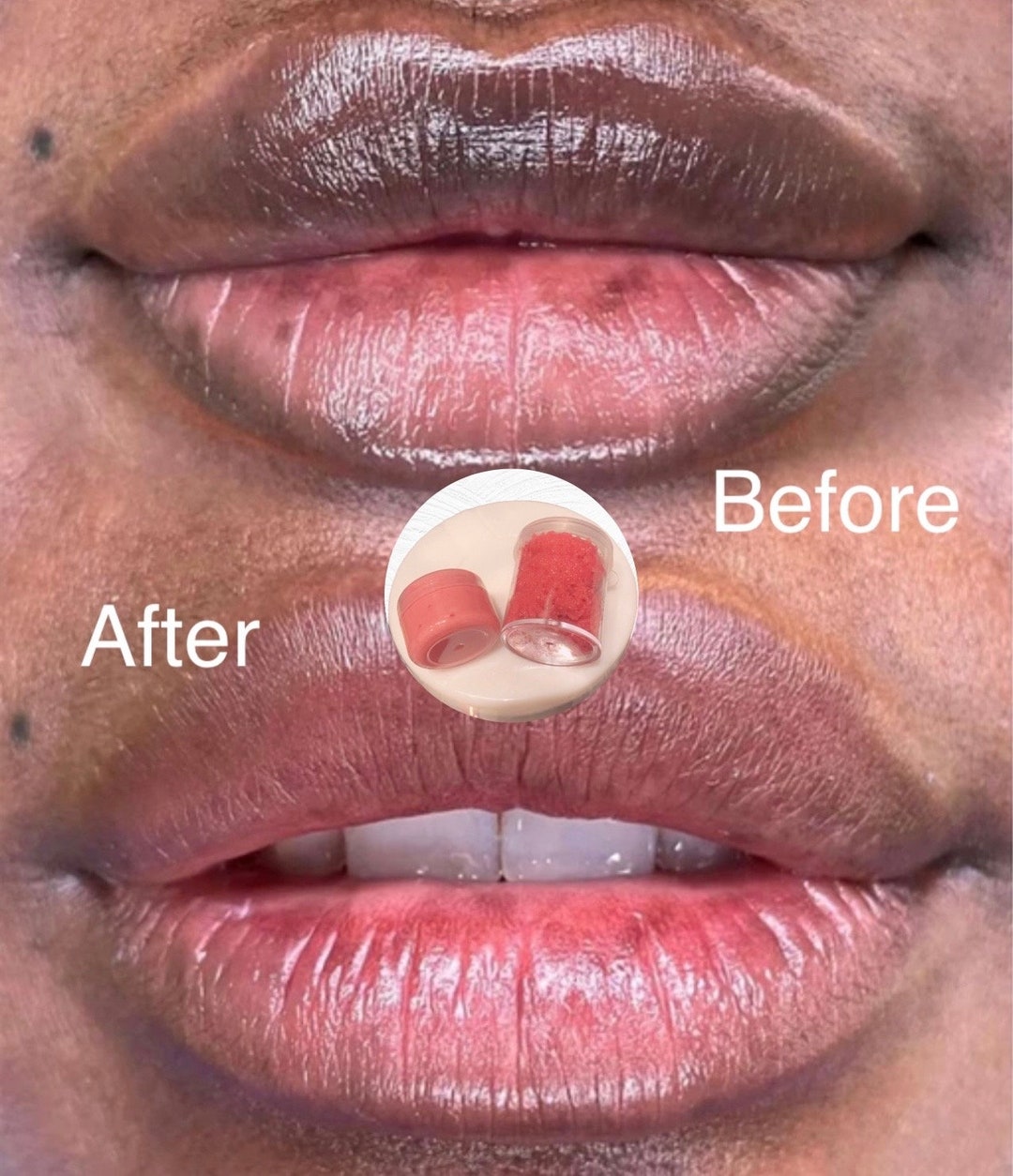 Dark Lips Treatment Pink Lips Set Etsy