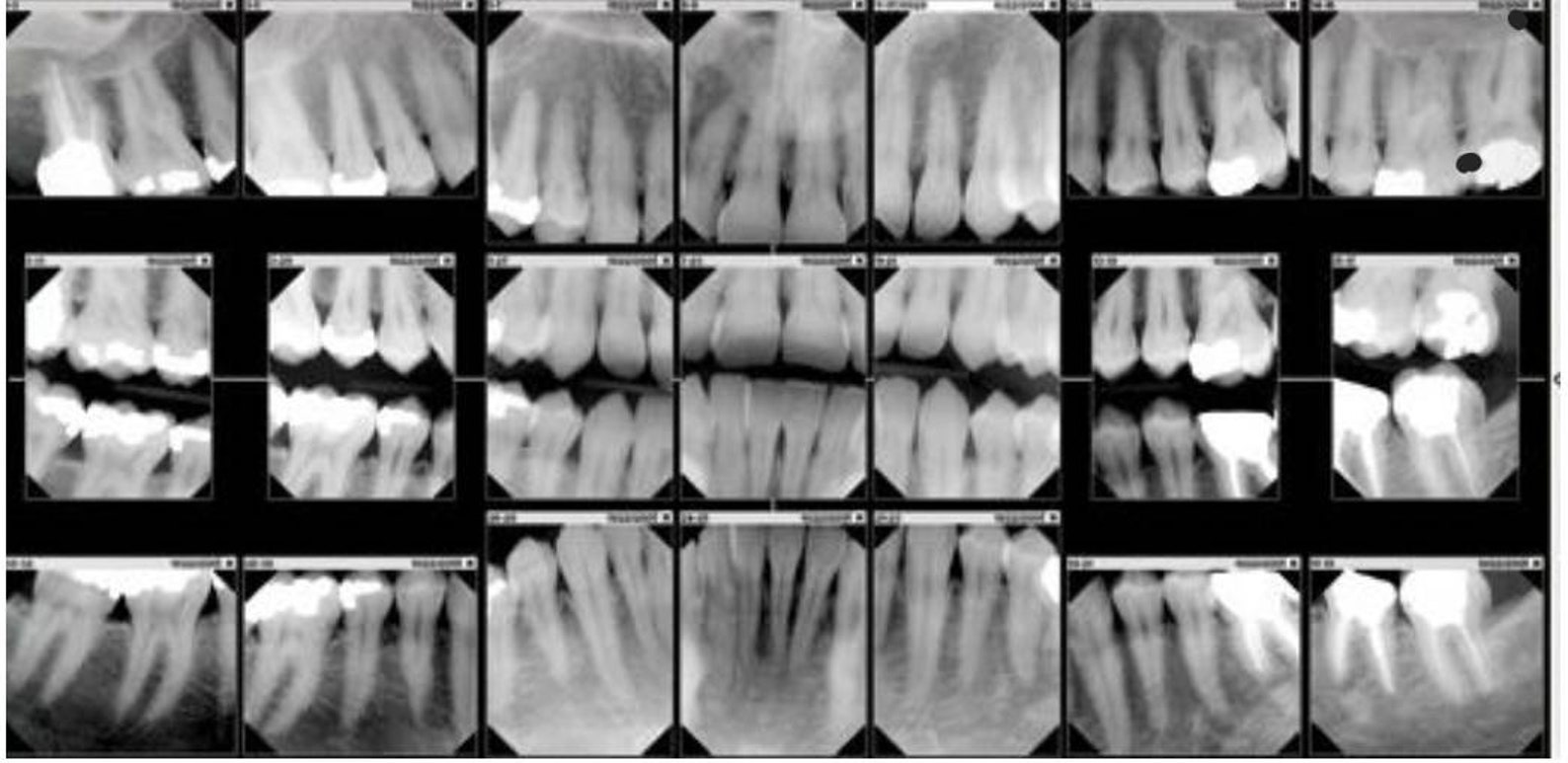 Vintage Dental Xray Hanger With Xrays Human Teeth Xray Etsy