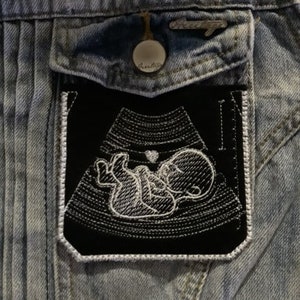 May include: Black and white embroidered patch of an ultrasound image with a baby inside. The patch is sewn onto a blue denim jacket.
