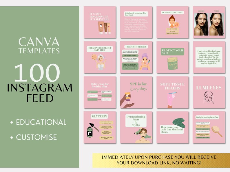May include: A pink and green graphic design template for 100 Instagram feed posts. The text "CANVA TEMPLATES 100 INSTAGRAM FEED" is at the top of the image. The text "EDUCATIONAL" and "CUSTOMISE" are at the bottom of the image. The image is divided into a grid of 12 squares, each containing a different graphic design element related to skincare. The text "IMMEDIATELY UPON PURCHASE YOU WILL RECEIVE YOUR DOWNLOAD LINK, NO WAITING!" is at the bottom of the image.