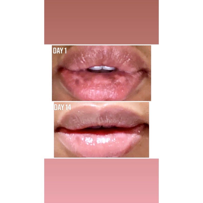 Apollo Rose Lip Lightening Balm Etsy