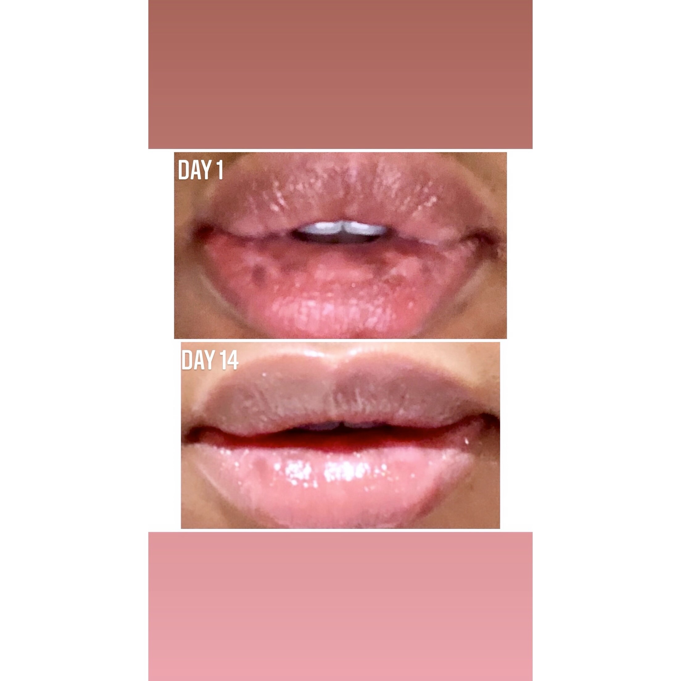 Apollo Rose Lip Lightening Balm