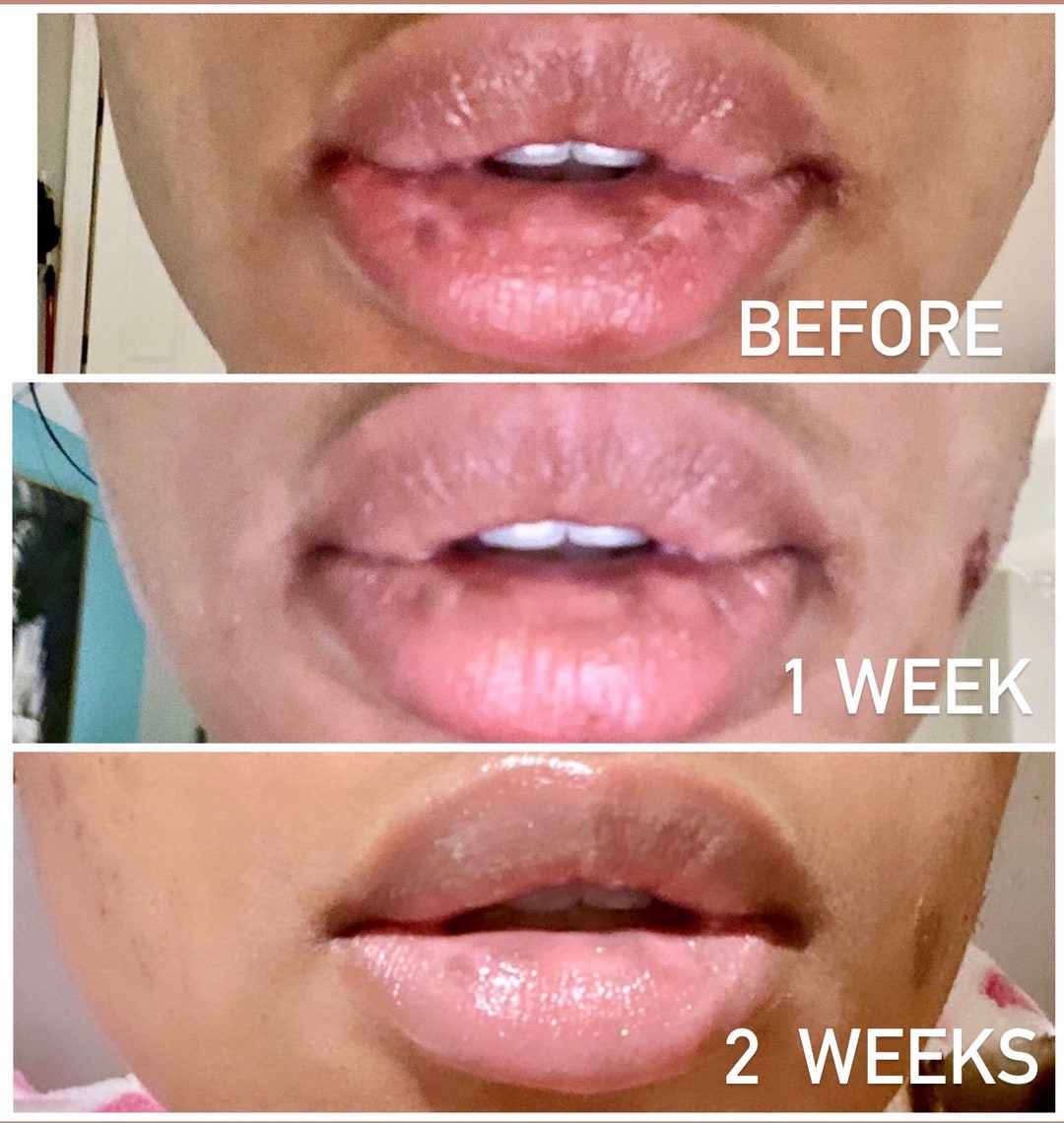 Apollo Rose Lip Lightening Balm Etsy