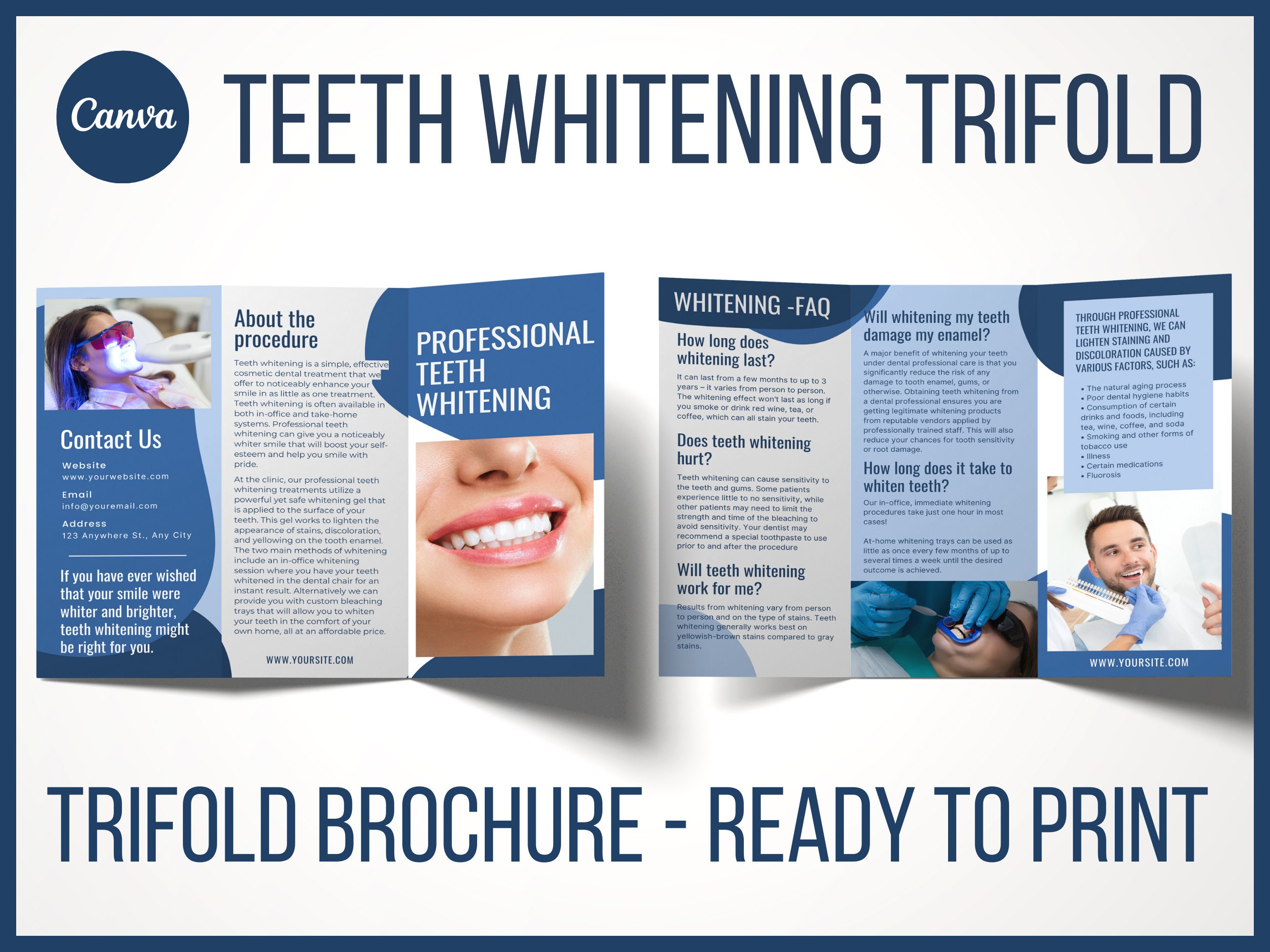 Printable Professional Teeth Whitening Trifold Brochure Template Canva Printable Professional Teeth Whitening Trifold Brochure Template Canva