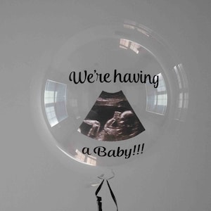 Baby Announcement Balloon, Custom Sonogram Balloon, Gender Reveal, We Are Having A Baby, Sonogram decal, 24 Inch And 36 Inch Balloon Size