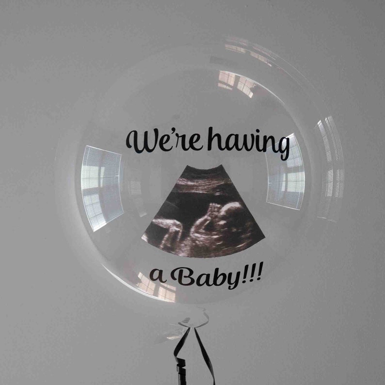Baby Announcement Balloon Custom Sonogram Balloon Gender Etsy