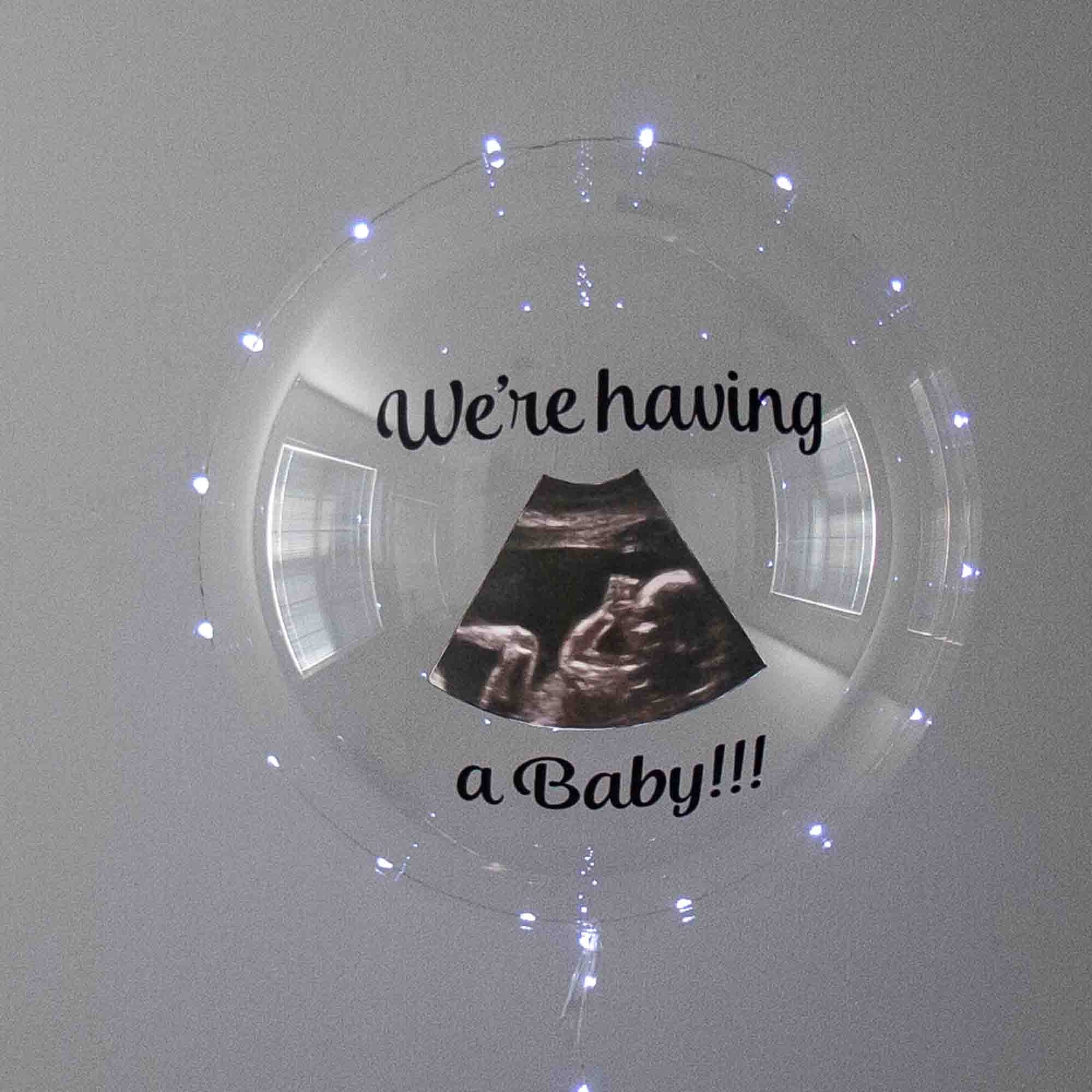 Baby Announcement Balloon Custom Sonogram Balloon Gender Etsy