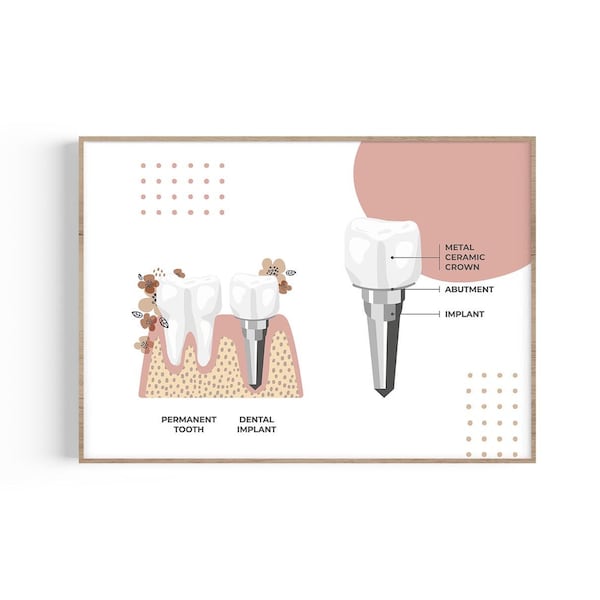 Dental Office Posters Etsy