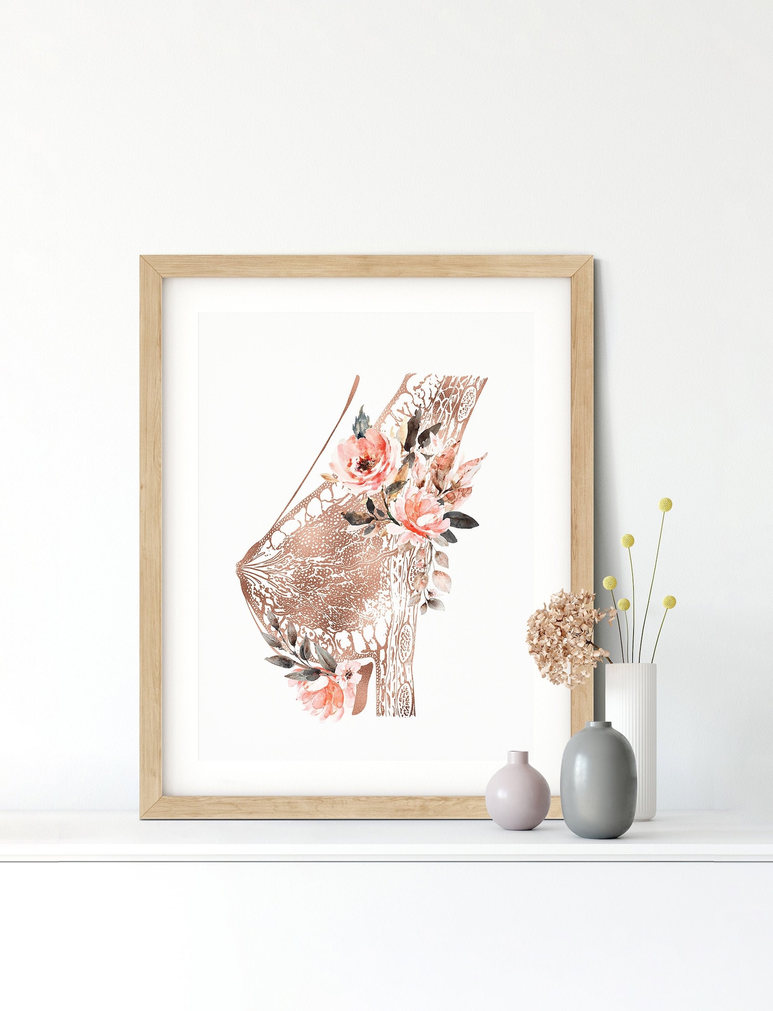 Breast Anatomy Print Mammary Gland Print OBGYN Art Breast - Etsy