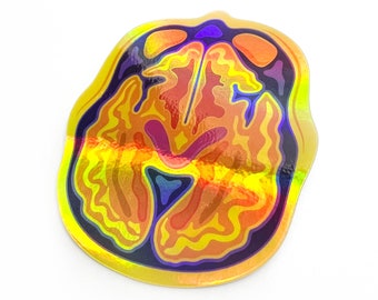 HOLOGRAPHIC Brain MRI/CT Vinyl Sticker | Anatomical Neuro Art