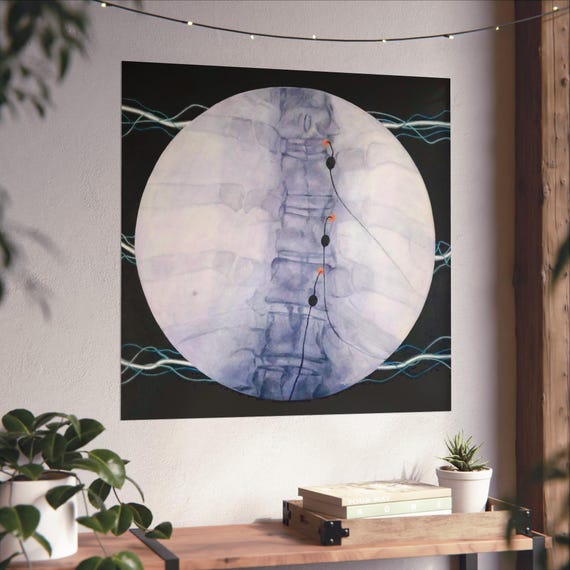 Arc print