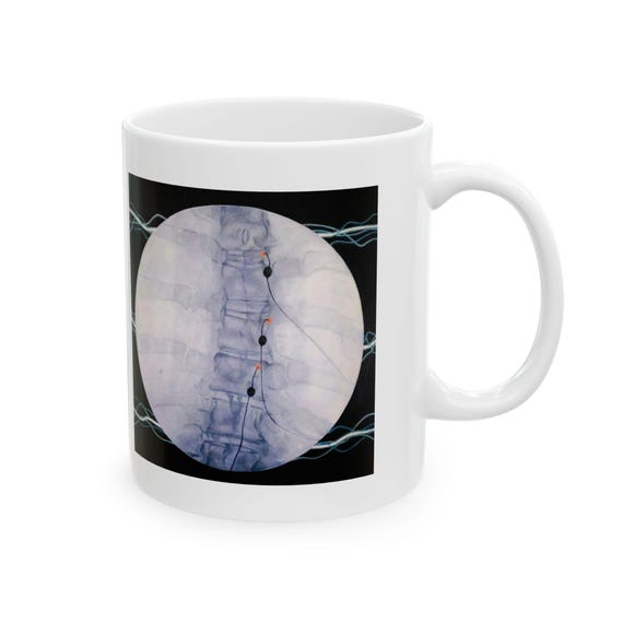 Arc mug