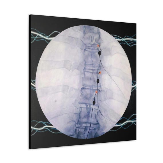 Arc Canvas Wrap