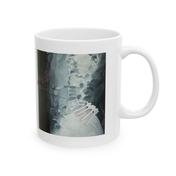 Care mug