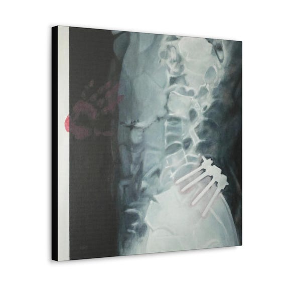 Care Canvas Wrap
