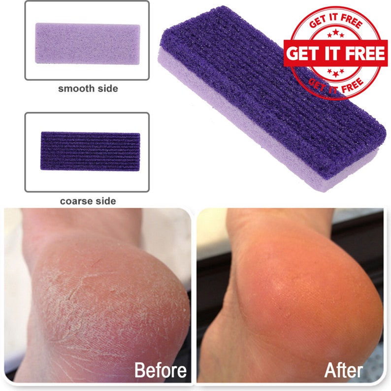 Professional Callus Remover Best Foot Peel Gel Liquid Corn Etsy