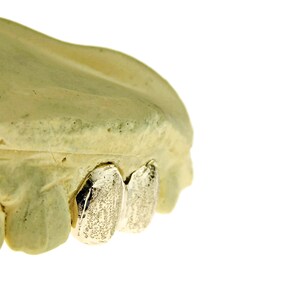 May include: Close-up of three gold teeth caps, also known as grills, on a model of a mouth. The caps are textured and have a brushed finish.