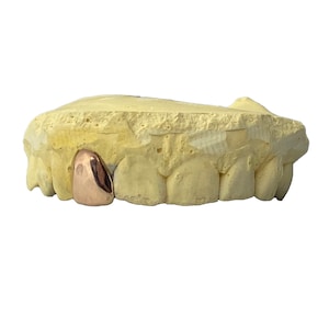 Solid 10K Rose Gold or 14K Rose Gold Single Cap Real Custom Fit Grillz Handmade Any One Tooth