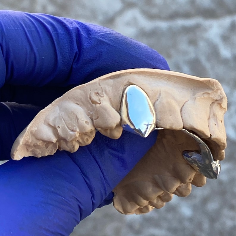 Puede incluir: Una tapa de diente de plata, tambi&eacute;n conocida como grill, se muestra en un molde de dientes humanos. La tapa de diente es un solo diente puntiagudo que est&aacute; dise&ntilde;ado para ser usado en el diente delantero.