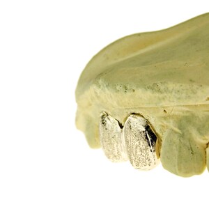 May include: Close-up of three gold-colored dental caps, also known as grills, on a model of a mouth. The caps are oval-shaped and have a textured surface.