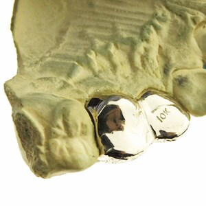 May include: Close-up of a gold tooth grill with the inscription "10K" on the side.
