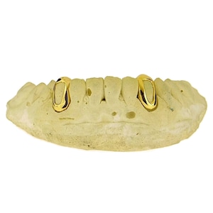 Solid 10K Gold OR 14K Gold Custom Fitted Single Cap Open Face Grillz Set 2 Two Teeth Includes Hidden Connecting Back Bar Bridge