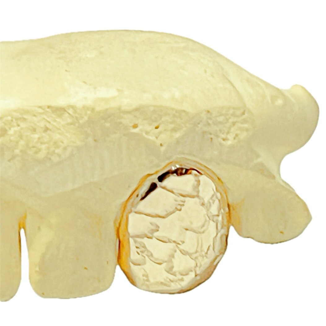 Solid Gold Nugget Grillz: Custom Single Tooth Cap (10K, 14K, 18K)