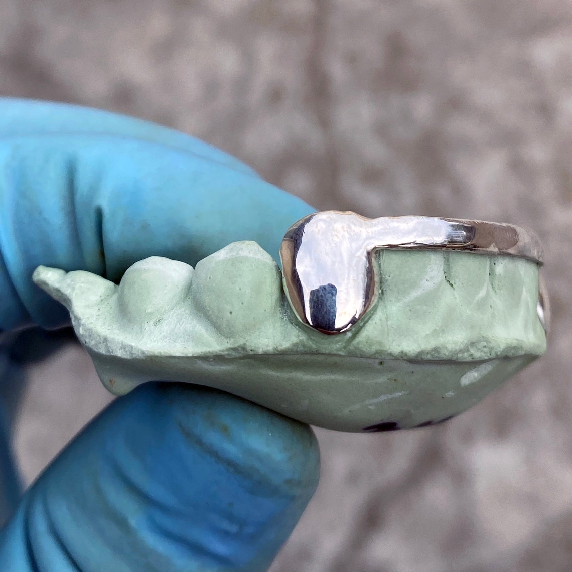 925 Sterling Silver Custom Fitted Tooth Caps Grillz Set Real Etsy Canada