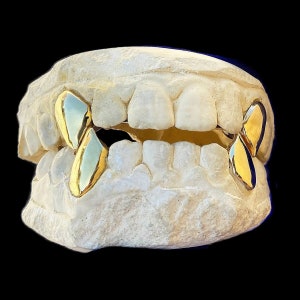 May include: Gold teeth grill with a white mold, showing the placement of the grill on the teeth.