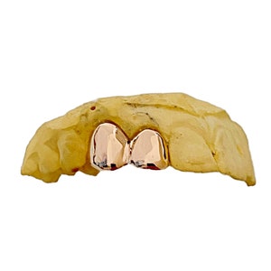 Solid 10K or 14K Rose Gold Real Custom Grillz Double Caps Grills Plain Two Teeth Connected Caps