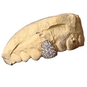 Real Natural Diamonds 10K Gold Single Cap Custom Grillz (You Choose Which Tooth)