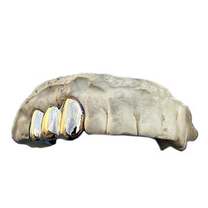 Real Solid 10K Gold or 14K Gold Custom Grillz Three Side Teeth Grills