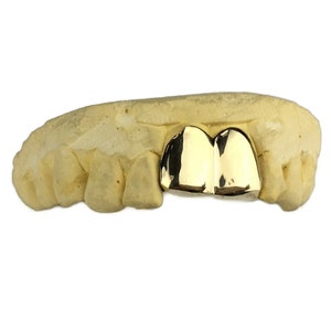 May include: Two gold front teeth grill, also known as a gold cap or gold tooth, on a dental mold.