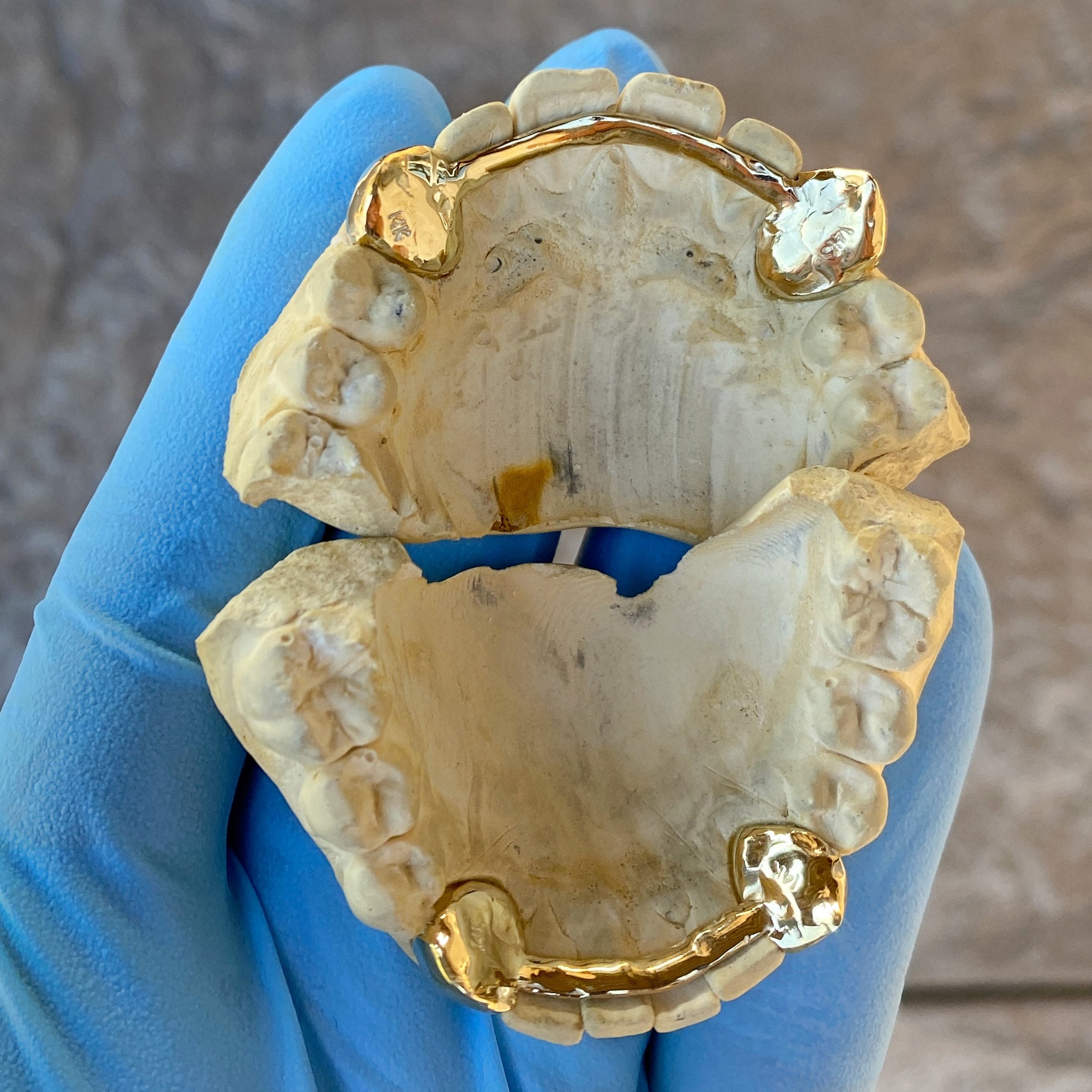 10K/14K Gold Fang Grillz: Custom Vampire Teeth Caps (set of 2) - Etsy