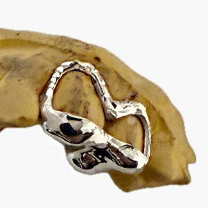 May include: A close-up of a silver dental crown, shaped like a heart, on a model of a tooth.