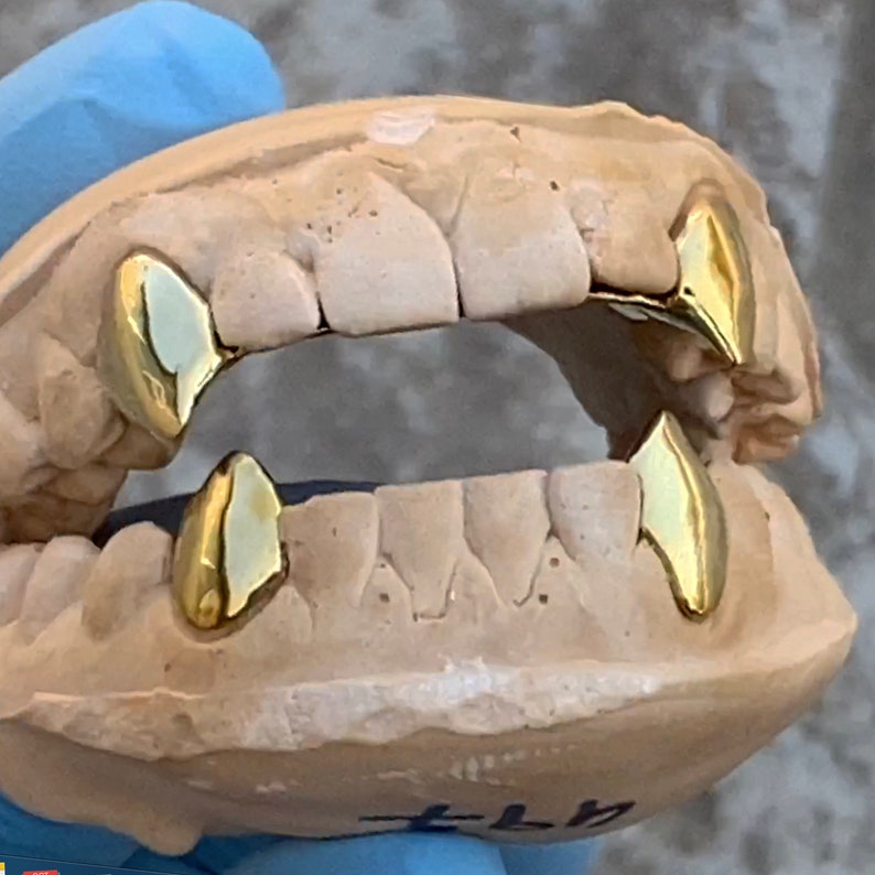 May include: Gold teeth grill with a set of six teeth, shown in a mold. The grill is made of solid gold and has a shiny finish.