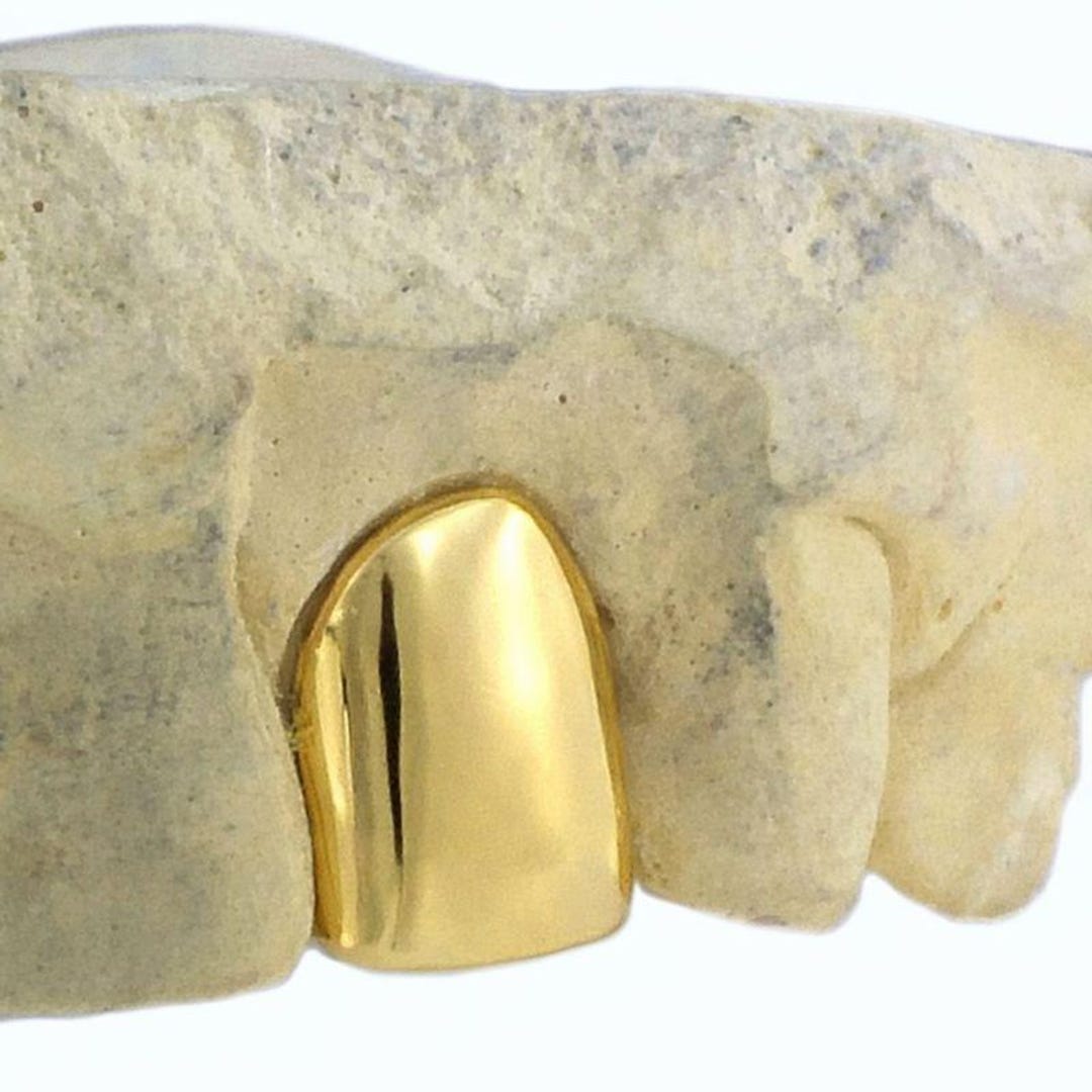 10K 14K 18K Gold Single Tooth Cap Grillz - Custom Fit, Handmade