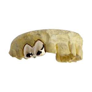 Real Solid 10K or 14K Gold Custom Double Caps (Canine & 1st Premolar)