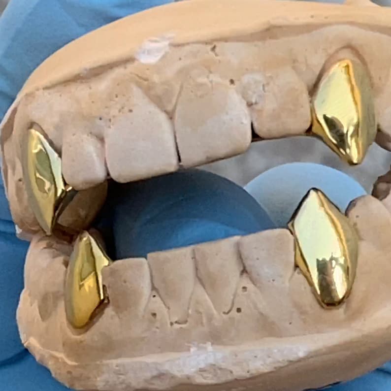 May include: Gold teeth grill with multiple gold teeth, set in a mold for fitting.
