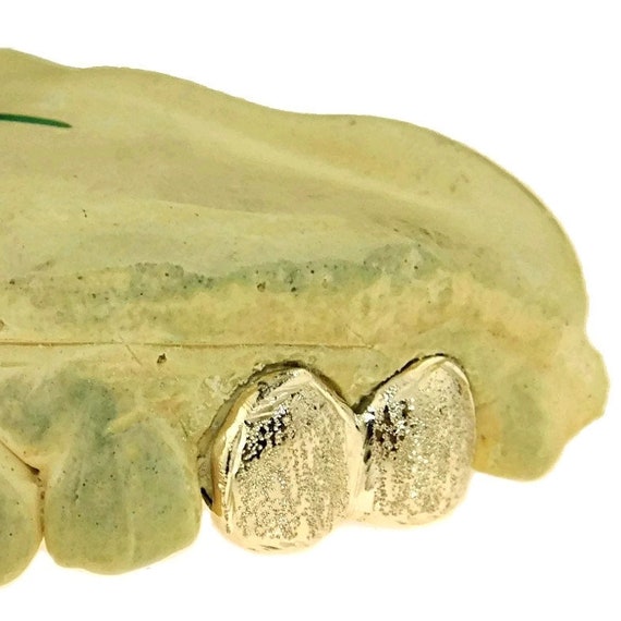 10K Solid Gold Grillz Custom Fitted Double Cap Teeth Diamond Dust Tooth Bling Grills