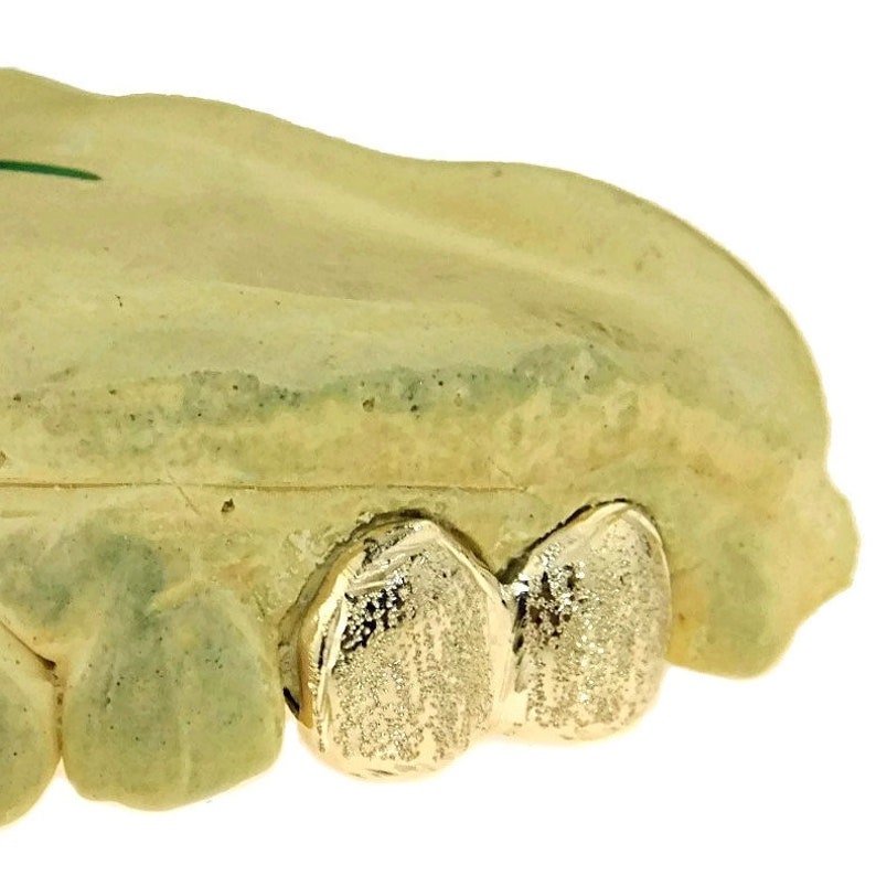May include: Close-up of two gold teeth grillz with a diamond-like pattern. The grillz are set against a light yellow background.