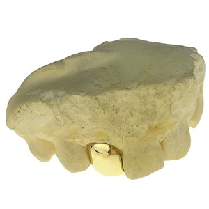 Solid 10K Gold or 14K or 18K Gold Single Cap Real Custom Fit Grillz Handmade Any One Tooth